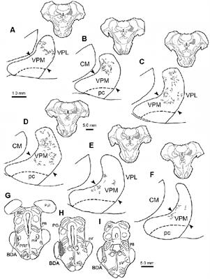 Morphologic Characterization of Trigeminothalamic Terminal Arbors Arising From the Principal Nucleus in the Macaque